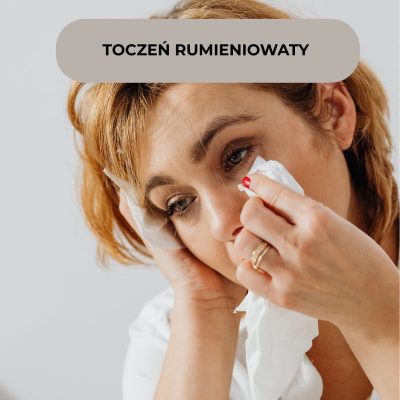 Toczeń rumieniowaty a dieta i suplementacja – całościowe wsparcie organizmu