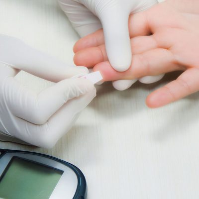 Kiedy zrobić badania na insulinę i glukozę na czczo – objawy i przygotowanie